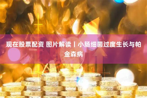 现在股票配资 图片解读丨小肠细菌过度生长与帕金森病